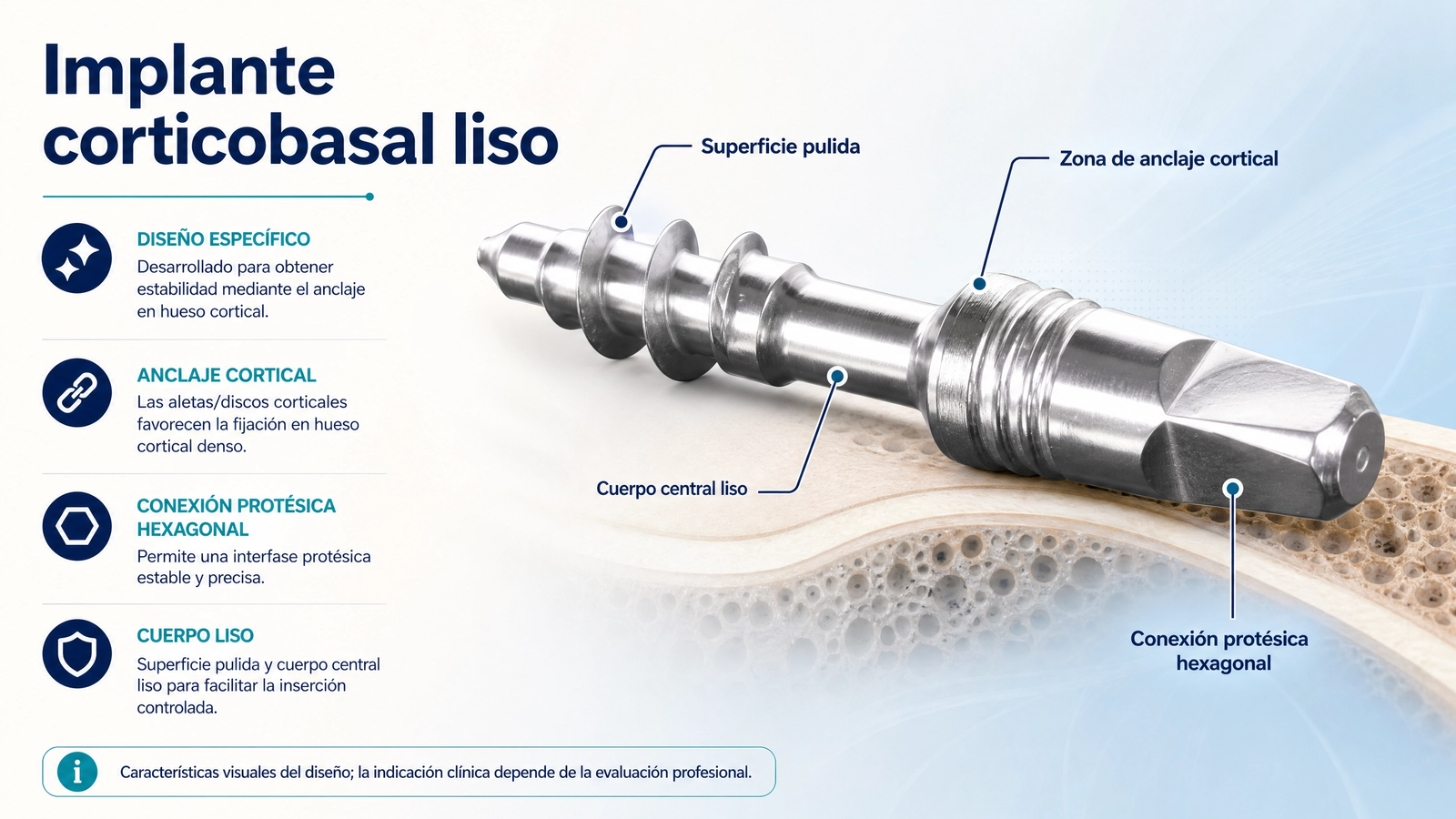 Implante corticobasal monobloque con anclaje diseñado para hueso cortical